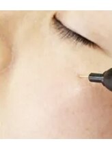 ヴィゴラス/シミケア