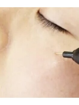 ヴィゴラス/シミケア