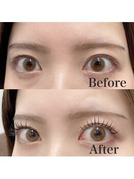 フーリー(fully)/瞳に光が入って、すっきり目元に