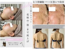 シイ(total skin beaute sii)