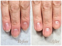 ソワン(soin)/Before→After