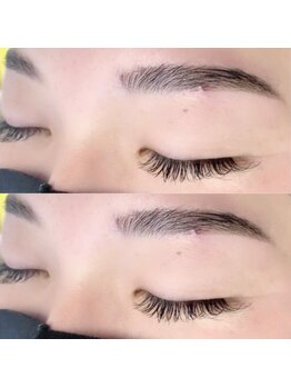 リンク(LINC.)/ハリウッドブロウリフト