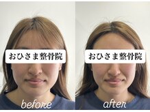 おひさま整骨院 整体院 姫路店/B＆A【姫路/小顔矯正/整体】