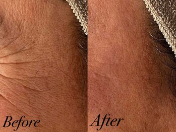 リララ 江坂店(Lelala)/★ビフォーアフター!