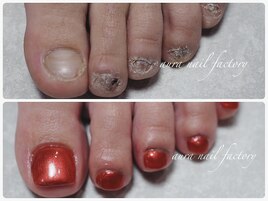 FOOT深爪矯正スカルプ［赤羽駅］