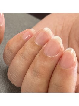 アモ ネイル(amo nail)/