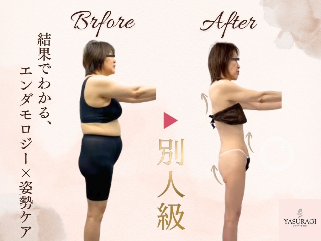 神戸駅でエンダモロジーが人気のエステサロン｜ホットペッパービューティー