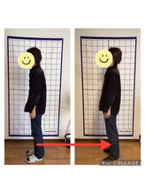 かなえ整体 武蔵新城駅前店/姿勢改善ビフォーアフター