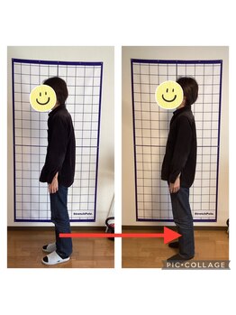 かなえ整体 武蔵新城駅前店/姿勢改善ビフォーアフター