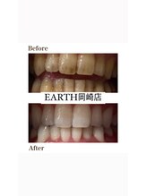 アース 岡崎店(EARTH)/ビフォーアフター