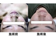 エステサロン JJシャンハイの雰囲気（光フェイシャルでシミケアくすみケア！お肌の透明感もアップ！）