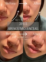 サロン エフ(salon f)/【泡雲フェイシャル】