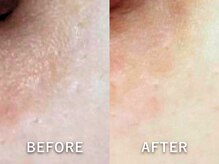 ドアディ(Doordie)/ローマピンク