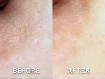 ドアディ(Doordie)/ローマピンク