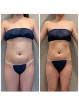 エクセレントビューティーサロン 艶(EN)/VENUS DIVA １３KG減量