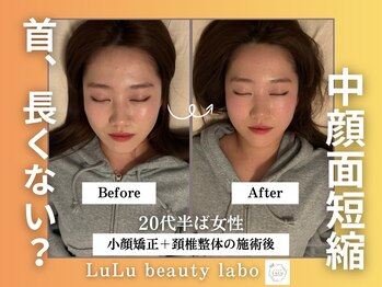 ルルラボ(LuLu beauty labo)の写真/【120分の贅沢な全身施術】《小顔矯正/背骨矯正/美容整体¥9,900】小顔矯正と一緒に姿勢も直したい方に。