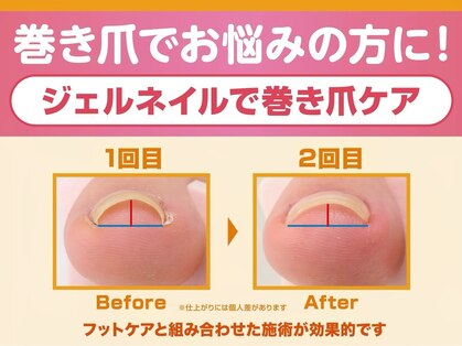 オーラリー ネイル アート メゾン(ORRERY nail art maison)の写真