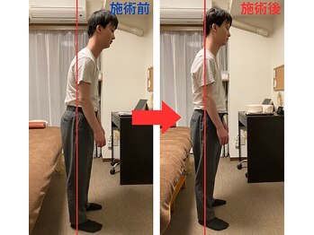整体院 澄/姿勢改善