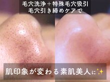 セルフィーの雰囲気（フェイシャル/ブライダルエステ/毛穴洗浄/美白エステ/小顔エステ）