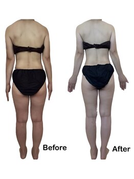 アロマテラピー 古香/話題のボディマシンでスッキリ