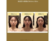 アジール 新潟市(agir)/Before/After画像