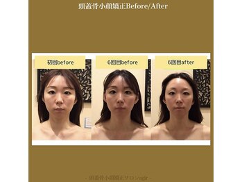 アジール 新潟市(agir)/Before/After画像