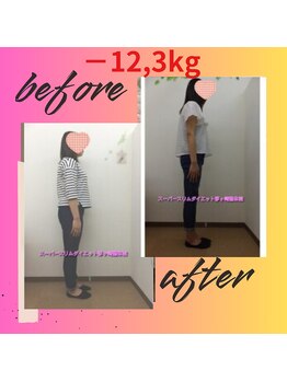 スーパースリムダイエット茅ヶ崎 茅ヶ崎整体院/3ヵ月－12,3ｋｇ減ダイエット♪