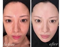 コリラ(CORILA)の雰囲気(トーンアップ/シミ/たるみに効果◎)