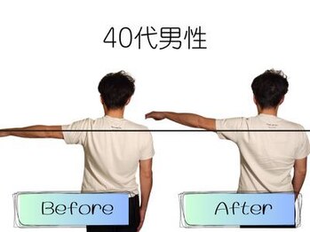 ビールーム 赤羽店(B-ROOM)/肩こりの悩み40代男性(左)