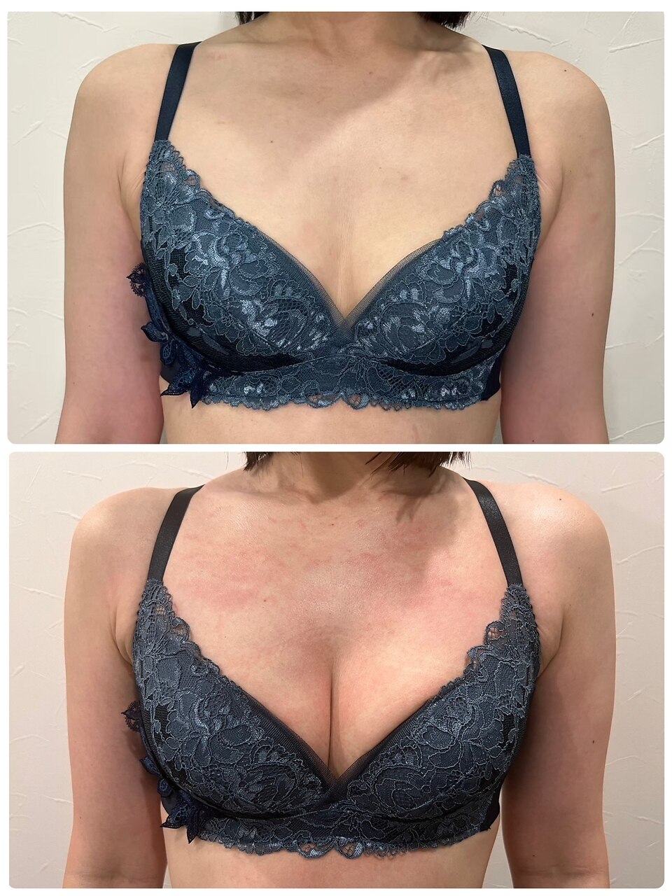 【Bust menu】高周波×EMSでバストケア、背中スリム、姿勢改善が叶う◎￥6600