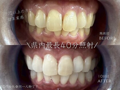ホワイトニングショップ 福岡香椎店の写真