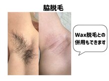 ゴールドプラス 都城店(GOLD PLUS)/ワックス脱毛も併用できます