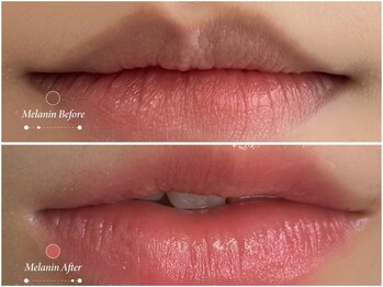 ピンクアンドプラウドサロン 横浜(Pink& Proud Salon)の写真/自分磨きのご褒美に。すっぴんに自信が持てるローマピンク。