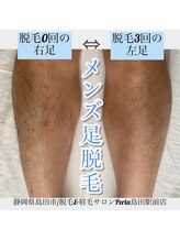 ぺルラ 島田駅前店(Perla)/メンズ足脱毛