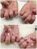 深爪矯正！ご相談下さい！深爪・噛み爪・弱い爪・自爪育成￥11000→￥8800