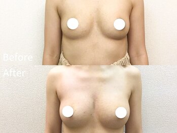 ウェルバスト(Well Bust)