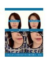 ハリラボ 仙台上杉店(hari Lab.)/【お客様の声】