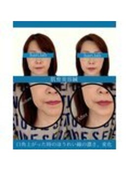 ハリラボ 仙台上杉店(hari Lab.)/【お客様の声】