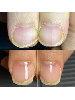 サンマルイチ(301)/