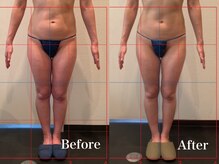 ジェイオー(J.O)/痩身コルギ/美脚コルギ/リンパ