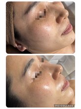 リボーン(be reborn)/艶やかになりました