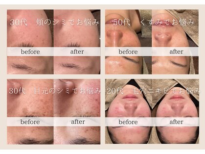 サロン リア(Salon Li’a)の写真