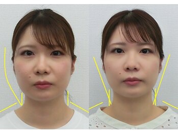 宮崎整体院/【美容整体】全身根本改善コース