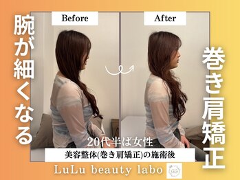 ルルラボ(LuLu beauty labo)の写真/《理学療法士による整体+背骨矯正¥6,600》巻き肩/肩こり/猫背/スマホ首/O脚など、悩みをまとめて改善◎