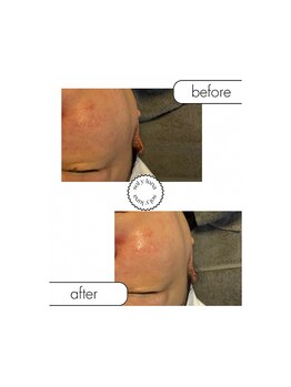 お肌の土台から整える sol y luna 麻布十番店【肌質改善/エイジングケア】/国内最大級の炭酸カーボキシー