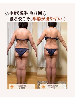 ユナリ(yunari)/40代後半｜Before・Afte…１