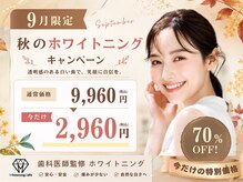 歯のホワイトニング 岐阜アクティブG店