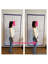 かなえ整体 武蔵新城駅前店/姿勢改善ビフォーアフター