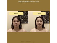 アジール 新潟市(agir)/Before/After画像