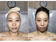 自然美人/小顔コルギの効果